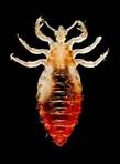 ..\Documenti\Immagini\230px-Body_lice.jpg