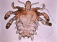 ..\Documenti\Immagini\230px-Pthius_pubis_-_crab_louse.jpg